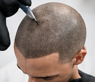 Hair tattoo treatment service